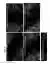 Fig. 10 - Use of nano metal in promoting neurite outgrowth and treatment and/or prevention of neurological disorders