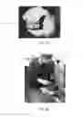Fig. 02 - Spinal disc regenerative composition and method of manufacture and use