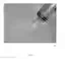 Fig. 04 - Spinal disc regenerative composition and method of manufacture and use