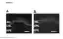 Fig. 07 - Methods for modulating development and function of photoreceptor cells