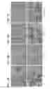 Fig. 10 - Attenuated chlamydia vaccine