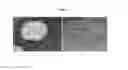 Fig. 02 - NOVEL AND SYNERGISTIC COMPOSITION OF LECITHIN AND LYSOLECITHIN FOR IMPROVING BIOAVAILABILITY AND SOLUBILITY OF HYDROPHOBIC COMPOUNDS AND EXTRACTS