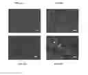 Fig. 10 - Constructs Binding to Phosphatidylserine and Their Use in Disease Treatment and Imaging