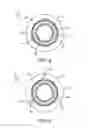 Fig. 05 - RETAINER DEVICE AND METHOD OF MOLDING SAME
