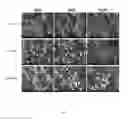 Fig. 03 - Magnesium-calcium Silicate Bone Cement, Matrix Powder thereof and Producing Method Thereof