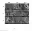 Fig. 06 - Magnesium-calcium Silicate Bone Cement, Matrix Powder thereof and Producing Method Thereof