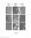 Fig. 02 - Allogeneic microvascular tissue for soft tissue treatments