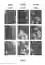 Fig. 03 - Allogeneic microvascular tissue for soft tissue treatments