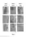 Fig. 06 - Allogeneic microvascular tissue for soft tissue treatments