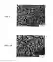 Fig. 04 - DRUG COATING LAYER