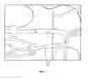 Fig. 04 - CORRECTION AND OPTIMIZATION OF WAVE REFLECTION IN BLOOD VESSELS