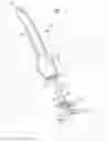 Fig. 02 - Ventricular assist device for intraventricular placement
