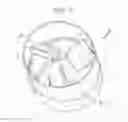 Fig. 06 - Ventricular assist device for intraventricular placement