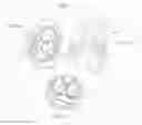 Fig. 08 - Ventricular assist device for intraventricular placement