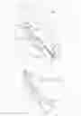 Fig. 16 - Ventricular assist device for intraventricular placement