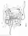 Fig. 02 - Medical fluid pumping systems and related devices and methods