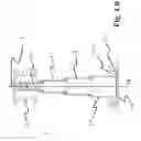 Fig. 03 - Port cannula system for puncturing port catheters