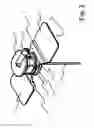 Fig. 04 - Port cannula system for puncturing port catheters