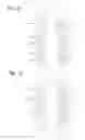 Fig. 08 - Assembly for a drug delivery device comprising a feedback feature