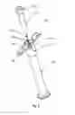Fig. 06 - Injection device having a needle protection device