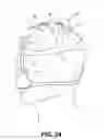 Fig. 18 - POSITIVE AIRWAY PRESSURE SYSTEMS