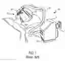 Fig. 02 - Phenotyping of sleep breathing disorders using a breathing therapy machine