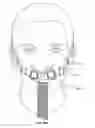 Fig. 23 - Facial interface and headgear system for use with ventilation and positive air pressure systems