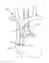 Fig. 01 - Method and system of utilizing ECG signal for central venous catheter tip positioning