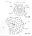 Fig. 06 - Head mounted IV holder assembly and method of use