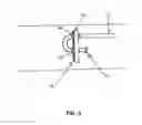 Fig. 04 - ABSORBENT AND ANTIMICROBIAL CUFF FOR CATHETER PLACEMENT