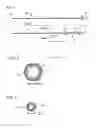 Fig. 02 - Guiding catheter assembly and method of using the same