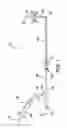 Fig. 02 - Guide catheters with guidewire deflection features