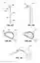 Fig. 05 - Guide catheters with guidewire deflection features