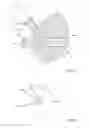 Fig. 12 - Devices, methods and kits for delivery of therapeutic materials to a pancreas