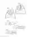Fig. 02 - APPARATUS AND METHOD FOR DEPLOYMENT OF A BRONCHIAL OBSTRUCTION DEVICE