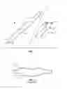 Fig. 02 - BALLOON CATHETER WITH IMPROVED COLUMN STRENGTH AND TORQUE TRANSMISSION