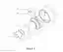 Fig. 02 - Extracorporeal membrane oxygenation cannula hemostatic plug