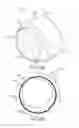 Fig. 33 - Surgical instrument for removing an implanted object