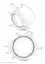 Fig. 35 - Surgical instrument for removing an implanted object
