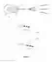 Fig. 04 - VESTIBULAR STIMULATION DEVICE