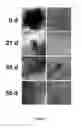 Fig. 08 - Nanosecond pulsed electric fields cause melanomas to self-destruct