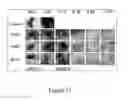 Fig. 12 - Nanosecond pulsed electric fields cause melanomas to self-destruct