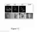 Fig. 13 - Nanosecond pulsed electric fields cause melanomas to self-destruct