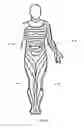 Fig. 07 - System for decreasing the blood flow of a targeted organ's artery with an electrical stimulation