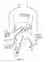 Fig. 05 - Treating inflammation, chronic pain and other disorders with neuromodulation