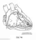 Fig. 15 - Treating inflammation, chronic pain and other disorders with neuromodulation