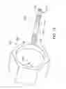 Fig. 20 - Treating inflammation, chronic pain and other disorders with neuromodulation