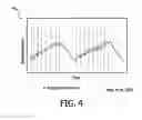 Fig. 04 - Defibrillator and method using limb leads for artifact free ECG