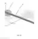 Fig. 14 - Ultrasound-based neuromodulation system
