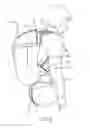 Fig. 03 - Enclosure release for a backpack with an inflatable airbag